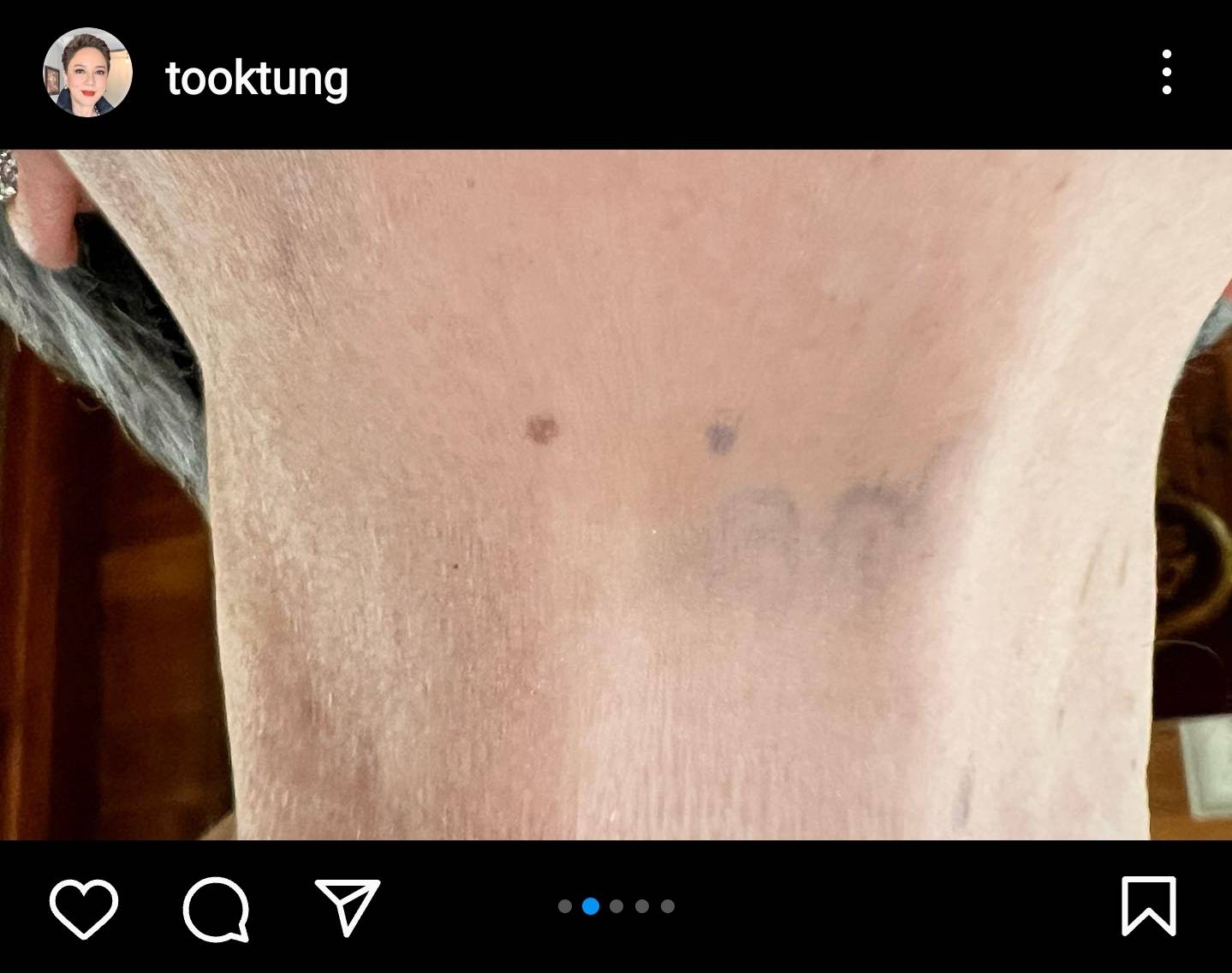 ตุ๊ก ดวงตา ชวนตีเลขเด็ดบนคอ แฟนละครห่วง แนะรีบหาหมอ