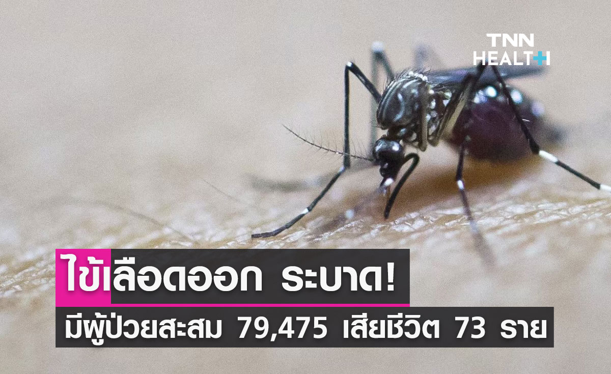 ไข้เลือดออกระบาด! มีผู้ป่วยสะสมแล้ว 79,475 คน เช็กอาการเข้าข่าย