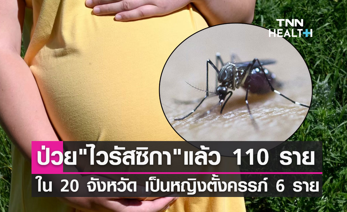 "ไวรัสซิกา" เชื้อร้ายจากยุงลาย! พบผู้ป่วยแล้ว 110 ราย ใน 20 จังหวัด