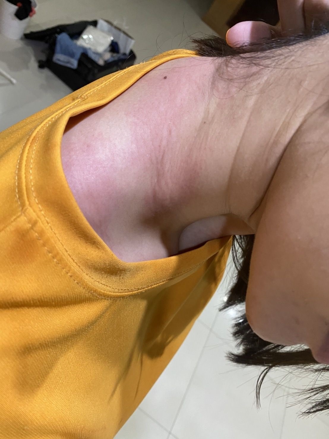 เเอ็ดมิทด่วน!! ฝ้าย สุภาพร เหตุเเพ้บาธบอมอย่างหนัก เเอ็ดมิทด่วน!! ฝ้าย สุภาพร เหตุเเพ้บาธบอมอย่างหนัก