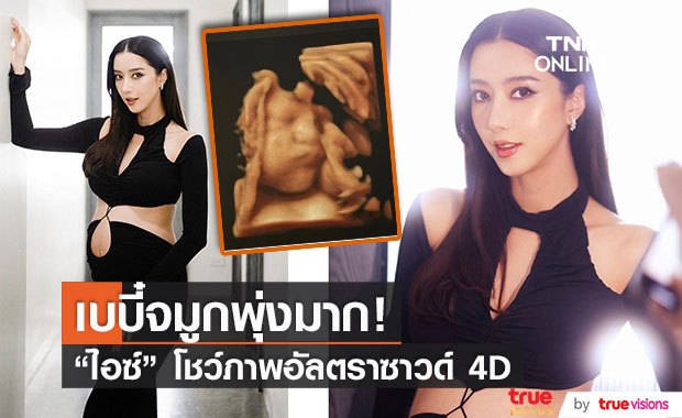 "ไอซ์ อภิษฎา" โชว์ภาพอัลตราซาวด์ 8 เดือน แฟนๆ แห่คอมเมนต์จมูกโด่งมาแต่ไกล