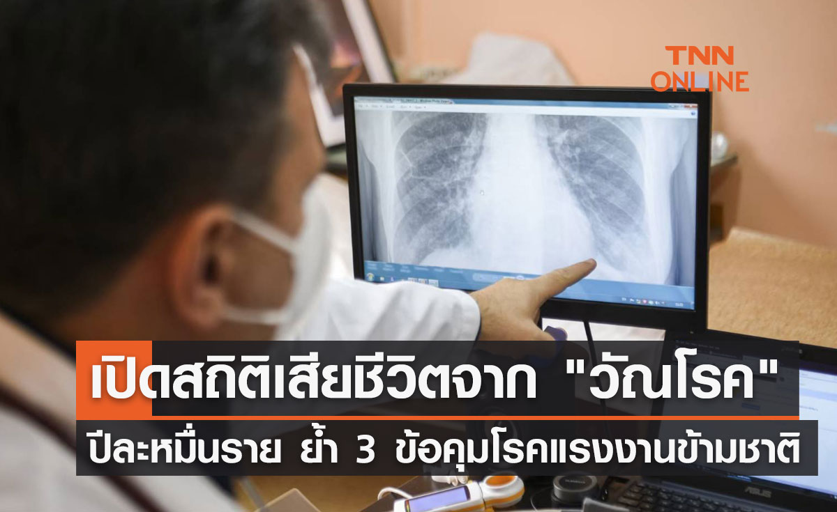 เปิดสถิติเสียชีวิตจาก "วัณโรค" ปีละหมื่นราย