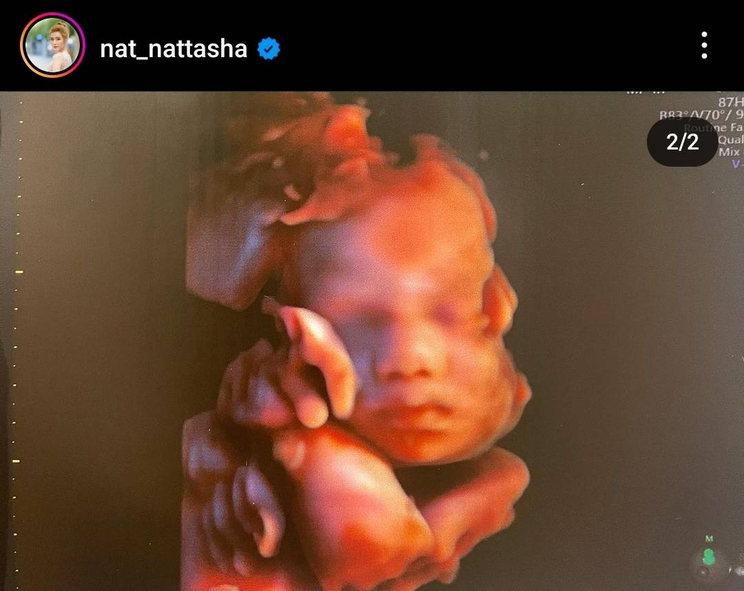 เกิดวันเดียวกันหมดเลย แนท ณัฐชา เผยวันคลอดลูกคนที่ 2