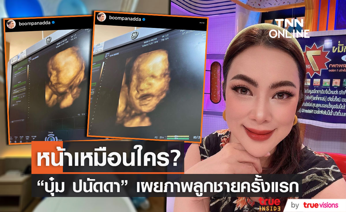 "บุ๋ม ปนัดดา" เผยภาพลูกชายครั้งแรก หน้าเหมือนใคร??