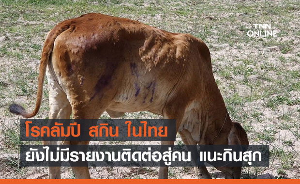 สธ.เผย "โรคลัมปี สกิน" ในไทย ยังไม่มีรายงานติดต่อสู่คน