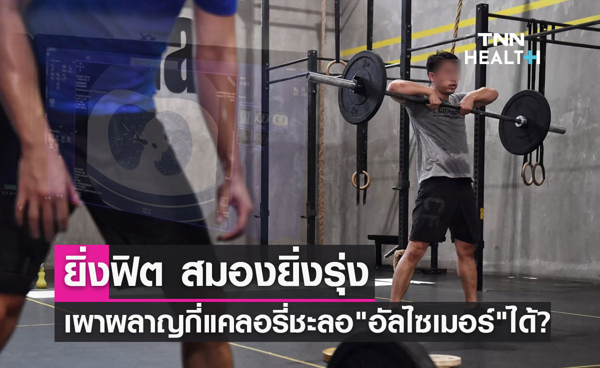 "อัลไซเมอร์" แนะวิธีออกกำลังกาย เผาผลาญกี่แคลอรี่ให้ผลดีชะลอโรคได้?