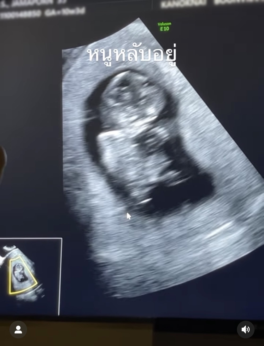 ตุ๊กตา จมาพร ขึ้นแท่นคุณแม่ป้ายแดง