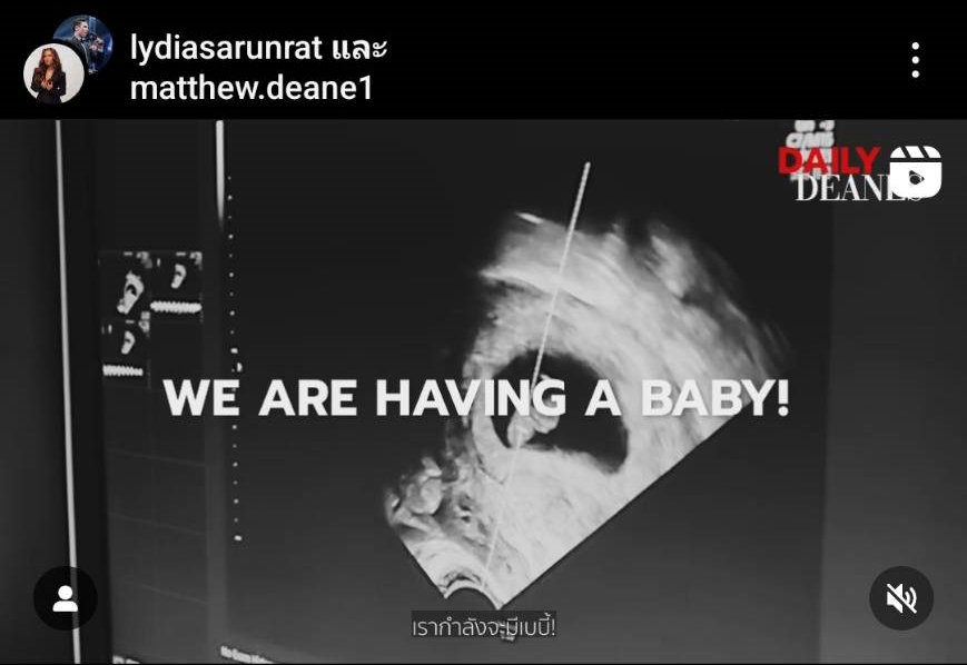 ลีเดีย เฉลยแล้ว! ภาพอัลตร้าซาวด์นั้นที่แท้เป็นลูกของน้องชาย ลีเดีย เฉลยแล้ว! ภาพอัลตร้าซาวด์นั้นที่แท้เป็นลูกของน้องชาย