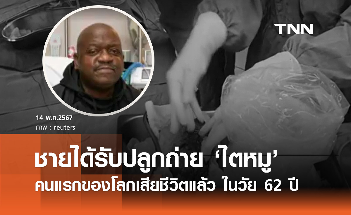 “ริชาร์ด สเลย์แมน” ผู้ป่วยปลูกถ่ายไตหมูคนแรกของโลก เสียชีวิตแล้ว