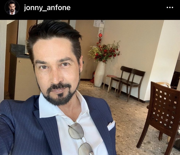 เสริมหล่อ!! จอนนี่ แอนโฟเน่ ทำศัลยกรรมหน้า 3 ส่วน 