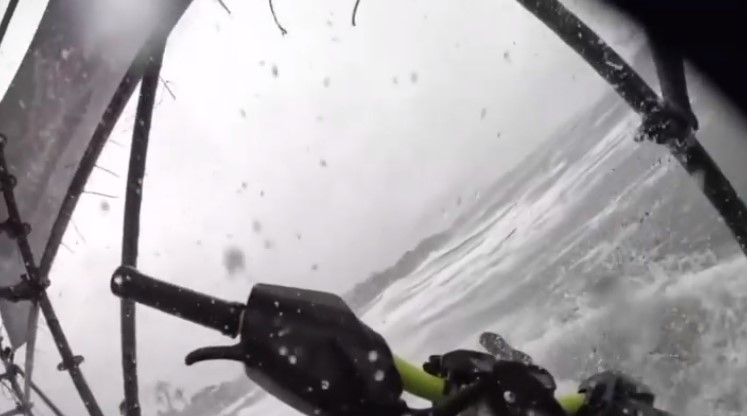 เปิ้ล นาคร ซี่โครงหักเพิ่ม 5 ซี่ รักษาตัวต่อที่บ้าน เปิ้ล นาคร ซี่โครงหักเพิ่ม 5 ซี่ รักษาตัวต่อที่บ้าน