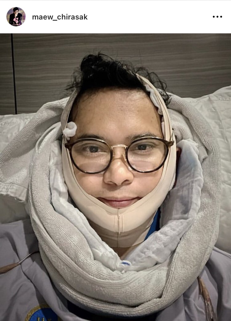 หล่อสมใจ! เปิดภาพ แมว จิรศักดิ์ หลังทำศัลยกรรม 20 วัน ลั่นนี่น้าแมวไม่ใช่ณเดชน์นะ 