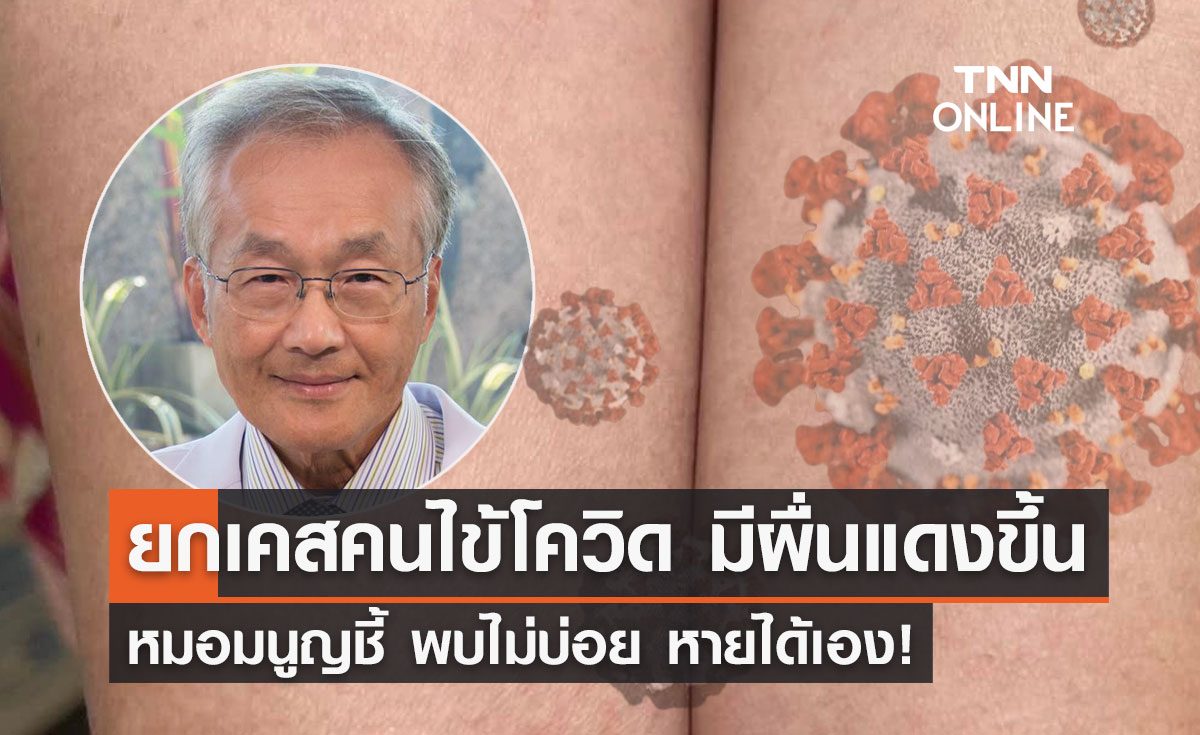 หมอมนูญ เผยเคสคนไข้ติดโควิด-19 มี "ผื่นแดง" ขึ้นแขน 2 ข้าง