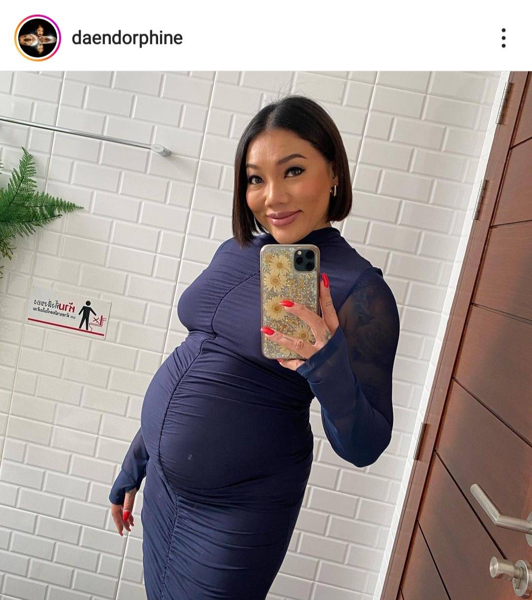 ดา เอ็นโดรฟิน-เดนนิส เผยชื่อลูกชายคนแรก เตรียมคลอดมกราคมนี้ ดา เอ็นโดรฟิน-เดนนิส เผยชื่อลูกชายคนแรก เตรียมคลอดมกราคมนี้