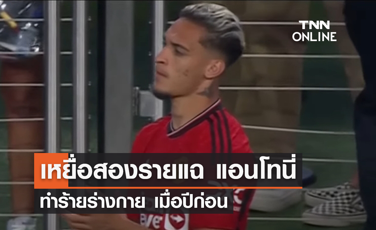 แอนโทนี่ ว้าวุ่นหนัก ถูกเหยื่อสองรายแฉเพิ่ม ข้อหาทำร้ายร่างกาย