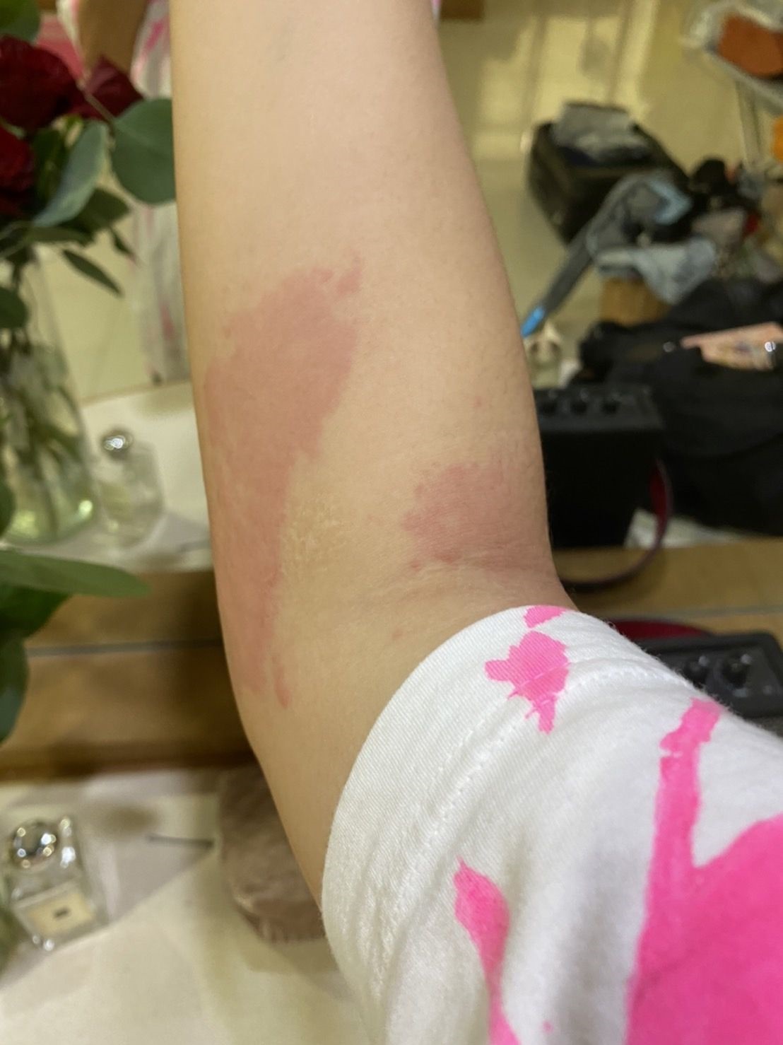 เเอ็ดมิทด่วน!! ฝ้าย สุภาพร เหตุเเพ้บาธบอมอย่างหนัก เเอ็ดมิทด่วน!! ฝ้าย สุภาพร เหตุเเพ้บาธบอมอย่างหนัก