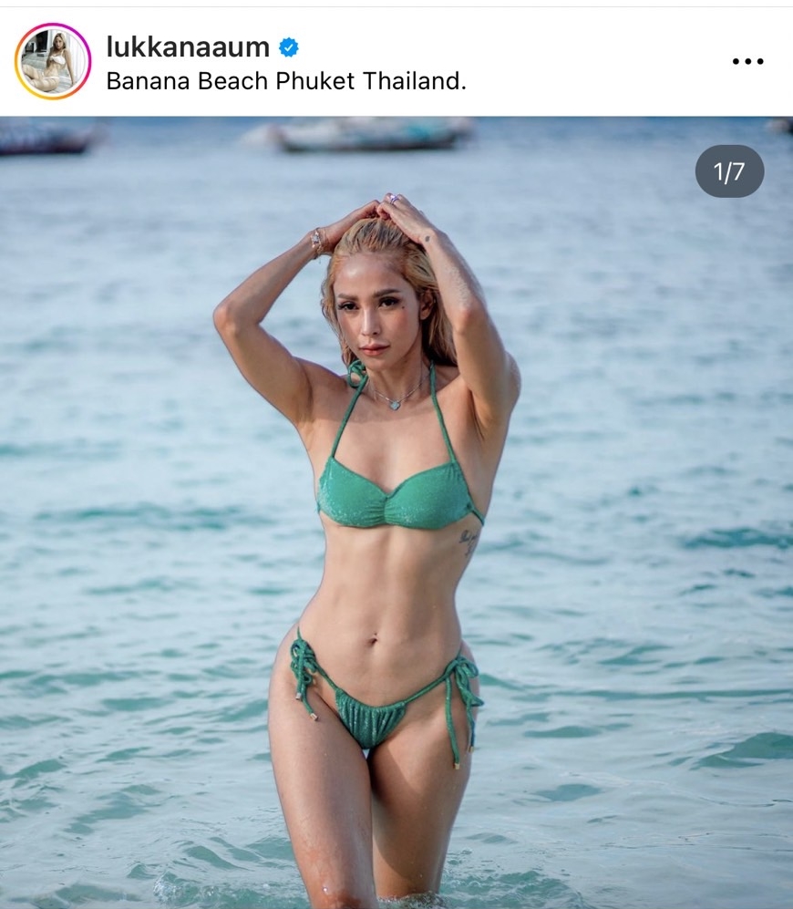 น้องดิสนีย์ ลูกสาว อุ้ม ลักขณา ได้รับบาดเจ็บ