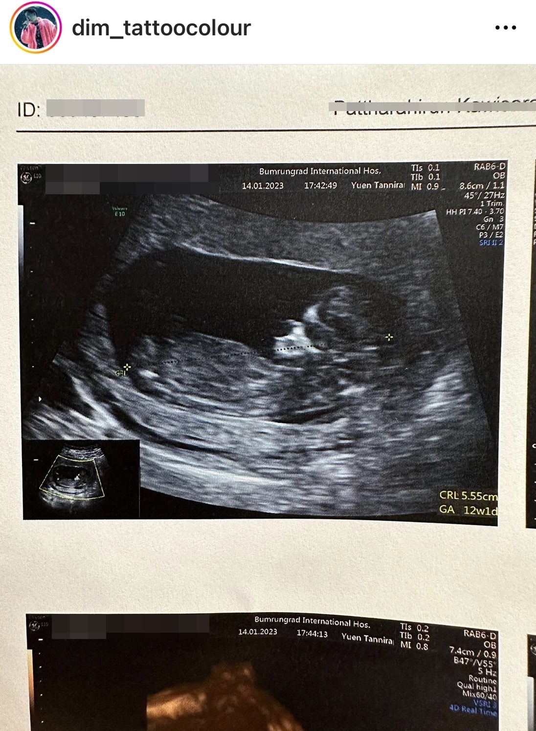 “ดิม Tattoo Colour” เฮลั่น! มีข่าวดี เบบี๋มาแล้ว เป็นของขวัญต้อนรับปีกระต่าย