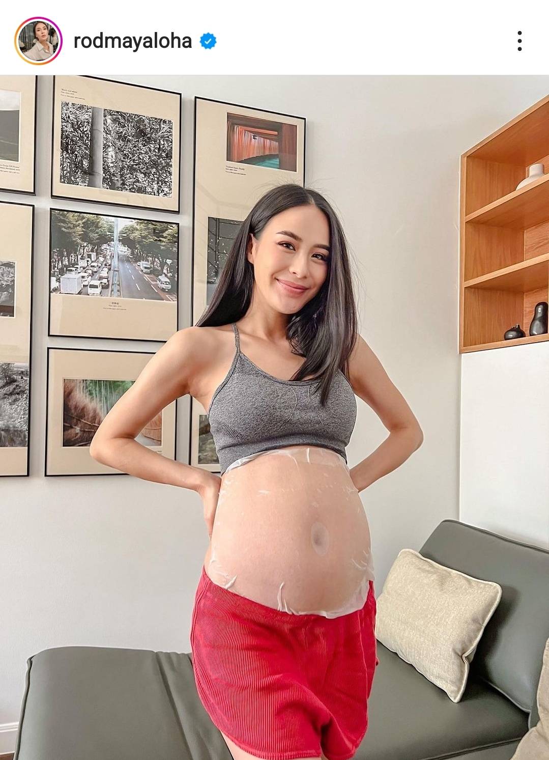 รถเมล์ คะนึงนิจ เล่าอาการแพ้ท้องหนัก ถึงขั้นเข้าโรงพยาบาล รถเมล์ คะนึงนิจ เล่าอาการแพ้ท้องหนัก ถึงขั้นเข้าโรงพยาบาล