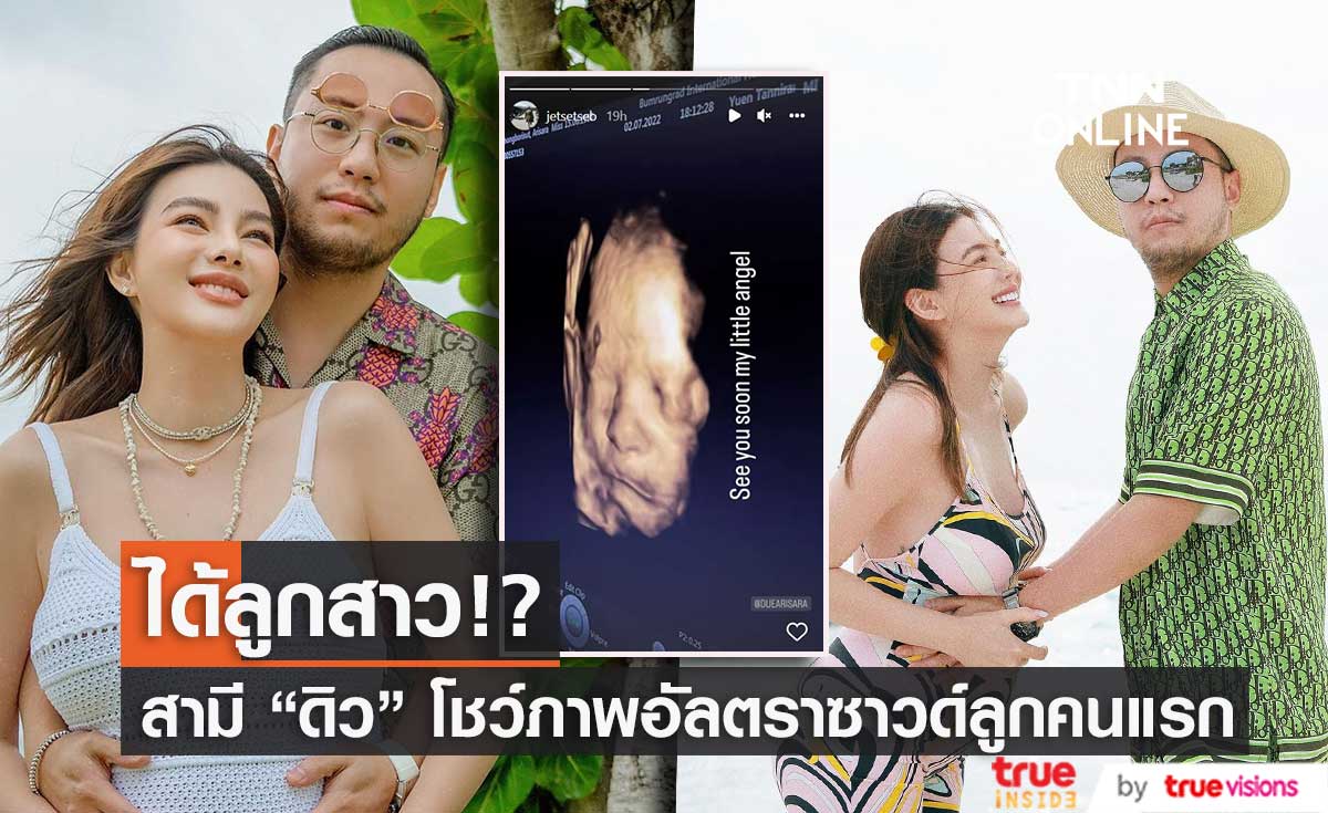 ได้ลูกสาว!? "เซบาสเตียน" สามี "ดิว อริสรา" โชว์ภาพอัลตราซาวด์ลูกคนแรก