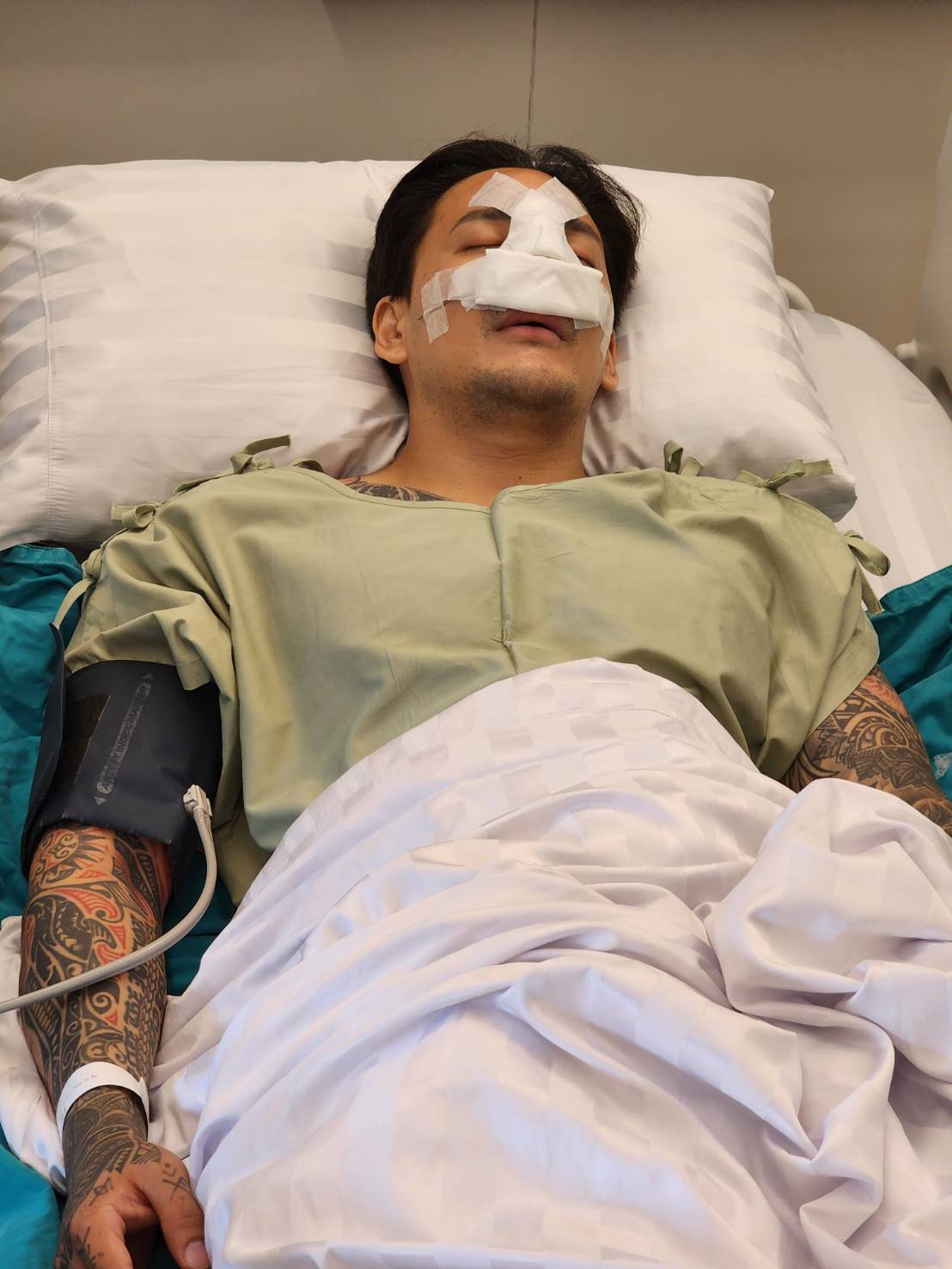 แทค ภรัณยู ออกจากห้องผ่าตัดแล้ว หลังถูกต่อยจมูกหัก แทค ภรัณยู ออกจากห้องผ่าตัดแล้ว หลังถูกต่อยจมูกหัก