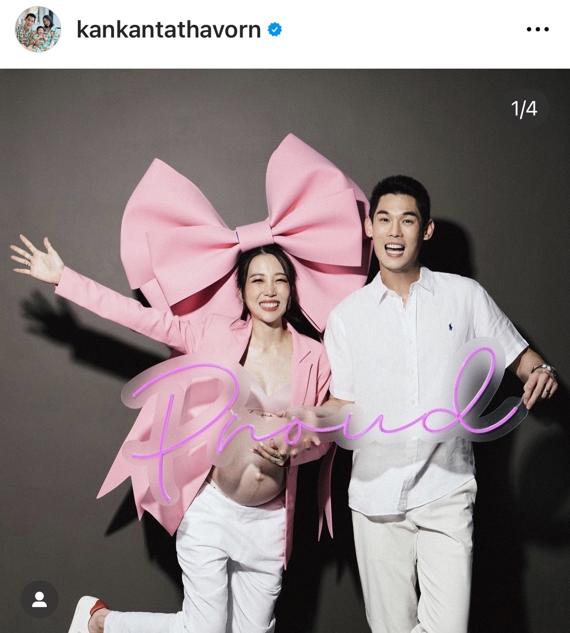 กันต์ กันตถาวร เฮลั่น! ภรรยาคลอดลูกสาว น้องพราว