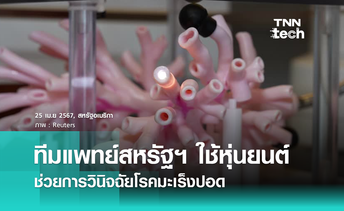 ทีมแพทย์สหรัฐฯ ใช้หุ่นยนต์เพื่อช่วยการวินิจฉัยโรคมะเร็งปอด