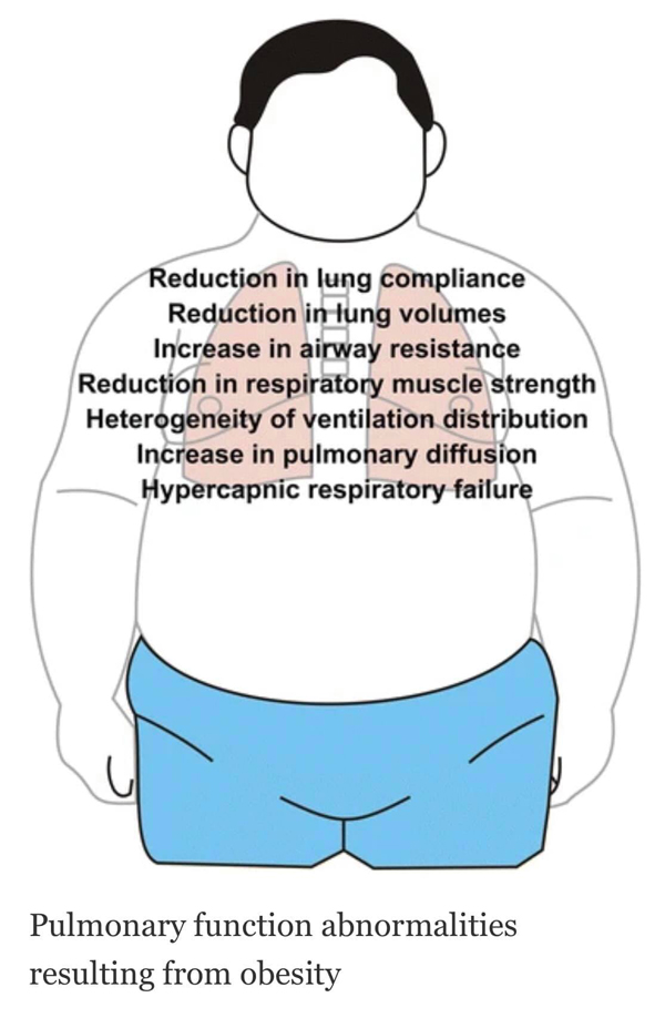 หมอมนูญ เปิดเหตุผลทำไม คนอ้วน เสี่ยงป่วย-เสียชีวิตเมื่อติดโควิด