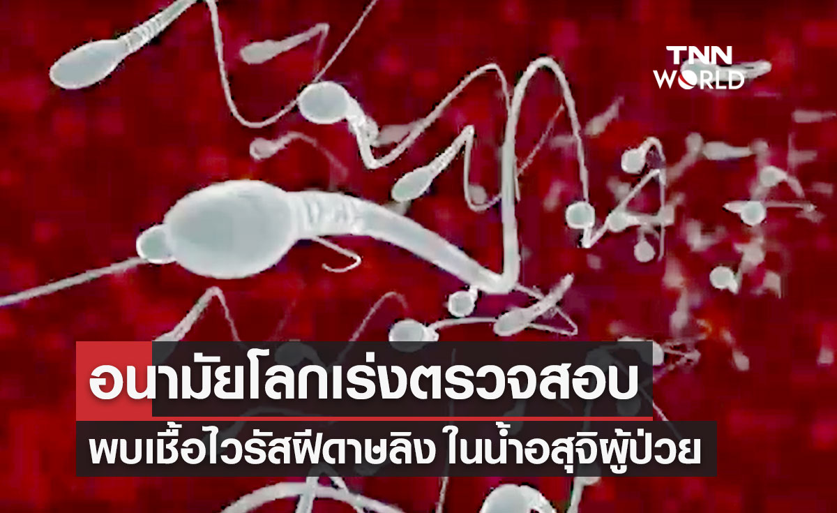 องค์การอนามัยโลก เร่งตรวจสอบหลังพบเชื้อไวรัส "ฝีดาษลิง" ในน้ำอสุจิผู้ป่วย