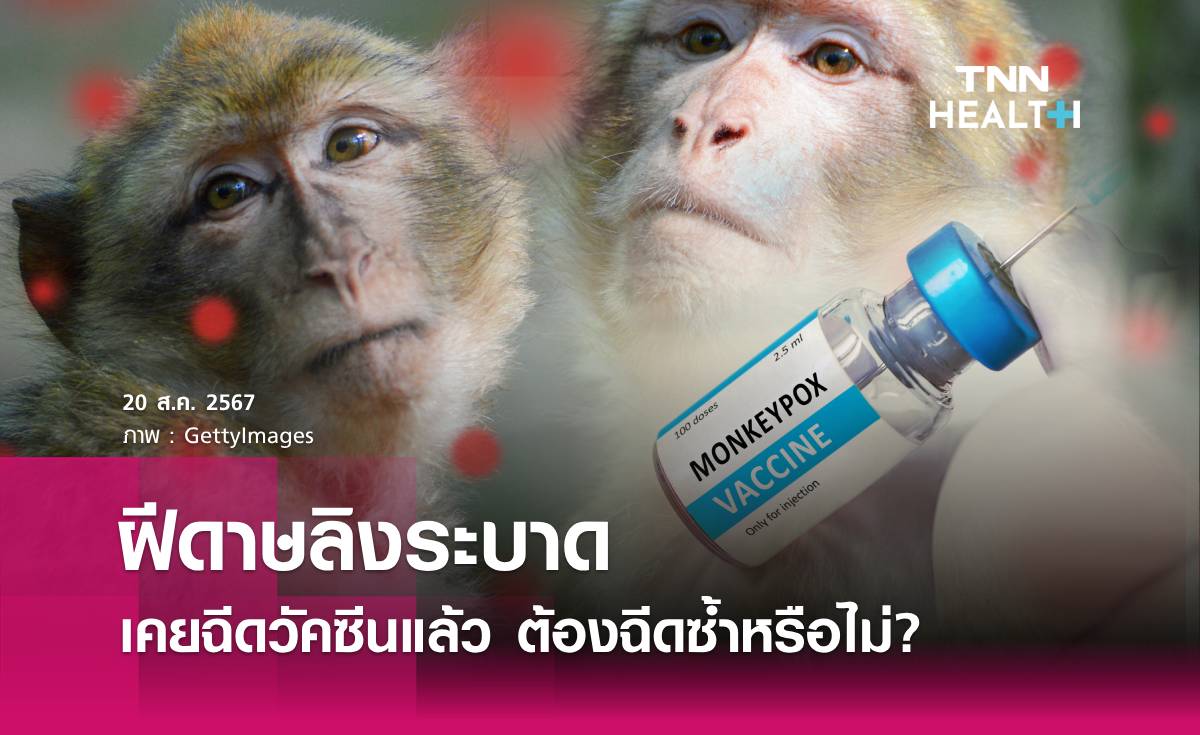 ฝีดาษลิงระบาด เคยฉีดวัคซีนแล้ว ต้องฉีดซ้ำหรือไม่?