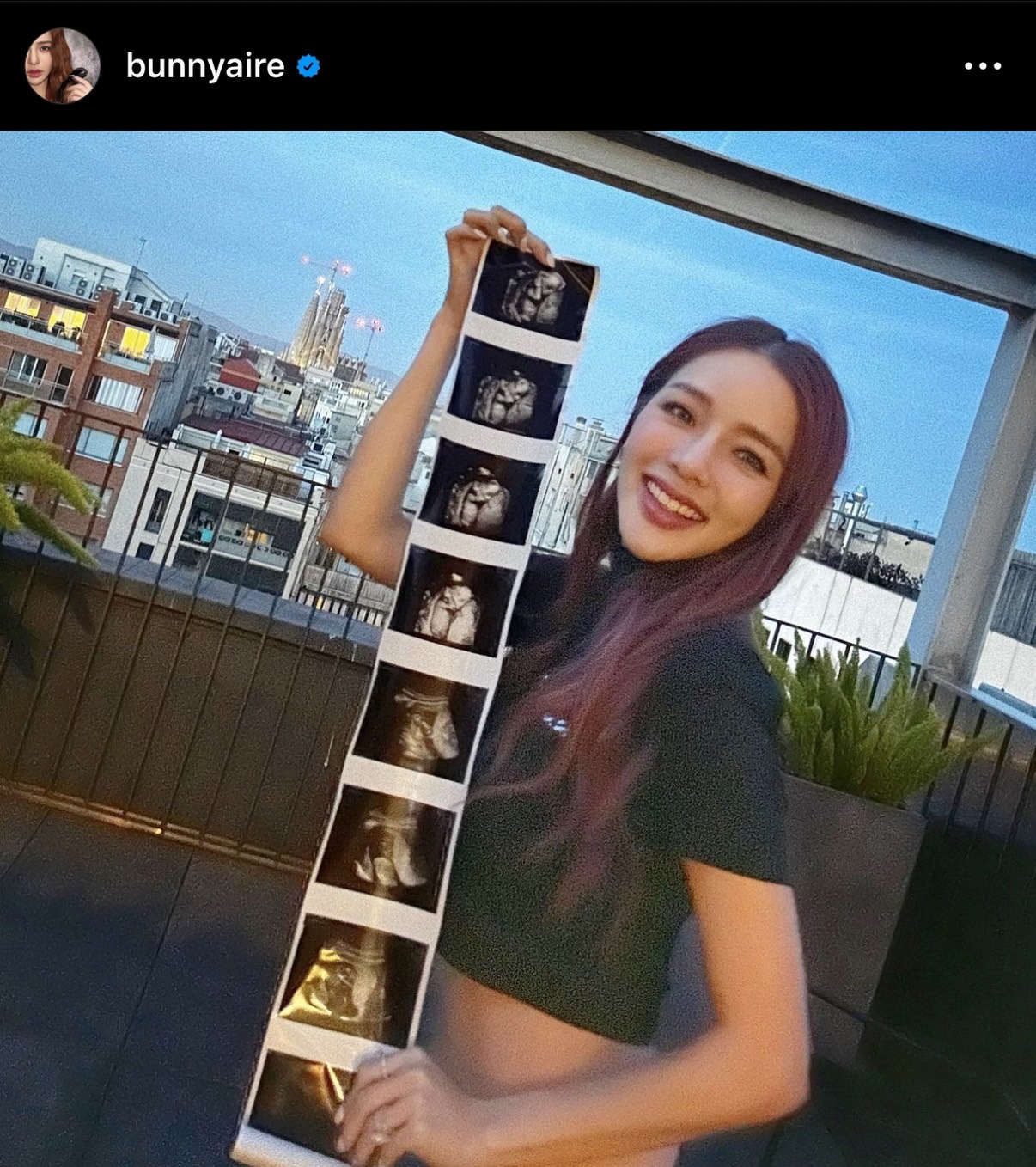 หัวใจพองฟู แอร์ ภัณฑิลา เผยโฉมลูกในท้องแบบชัดๆ ตื่นเต้น ใกล้ได้เจอแล้ว!