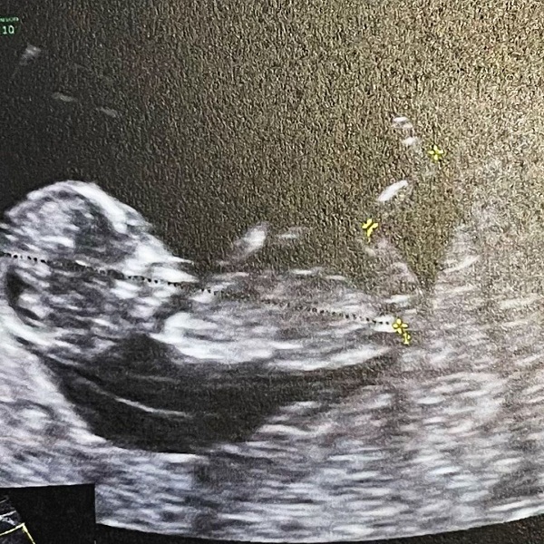 น้ำชา ชีรณัฐ ดีใจ เฉลยเพศลูกคนแรก เป็นเพศชาย (มีคลิป) น้ำชา ชีรณัฐ ดีใจ เฉลยเพศลูกคนแรก เป็นเพศชาย (มีคลิป)