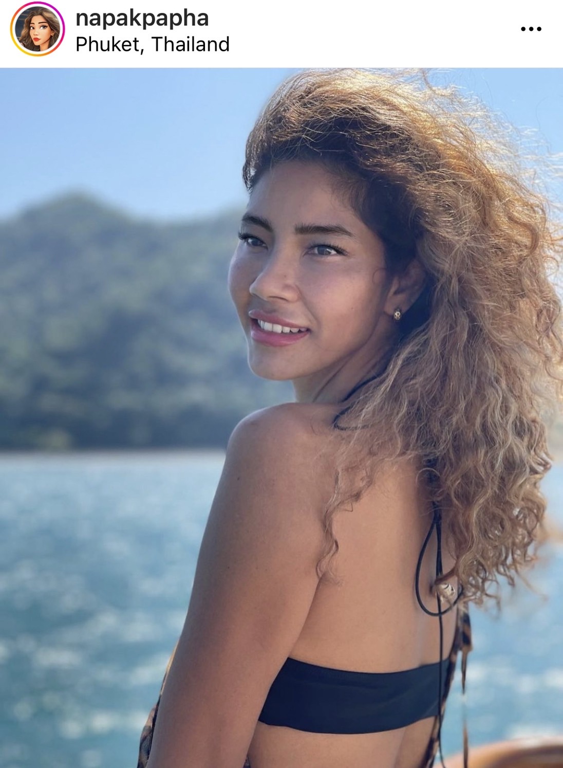 มะหมี่ นภคปภา เกิดอาการแพ้น้ำยาซักผ้ารุนแรง ถึงขั้นหายใจไม่ออก ตาบวม 