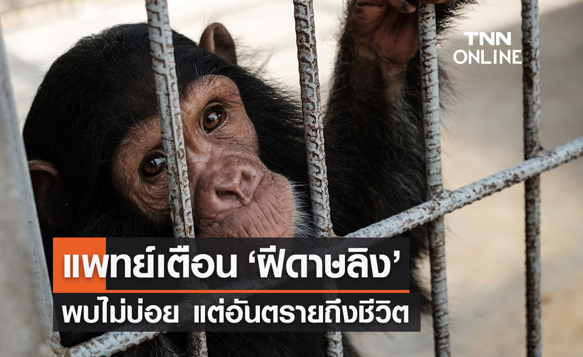 แพทย์ผิวหนังเตือน "ฝีดาษลิง" เป็นโรคติดต่อจากสัตว์ที่พบไม่บ่อย แต่อันตรายถึงชีวิต