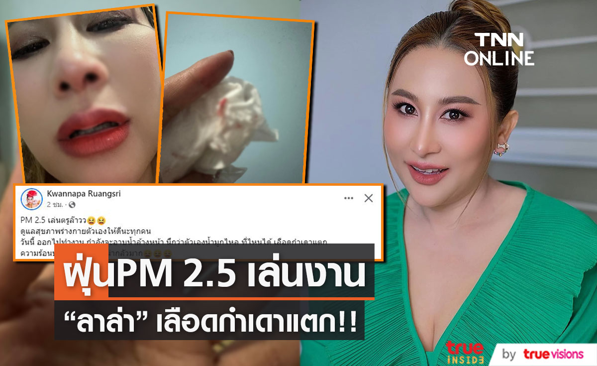"ลาล่า" แชร์ภาพเลือดกำเดาแตก หลัง โดนฝุ่น pm2.5 เล่นงาน! (มีคลิป)