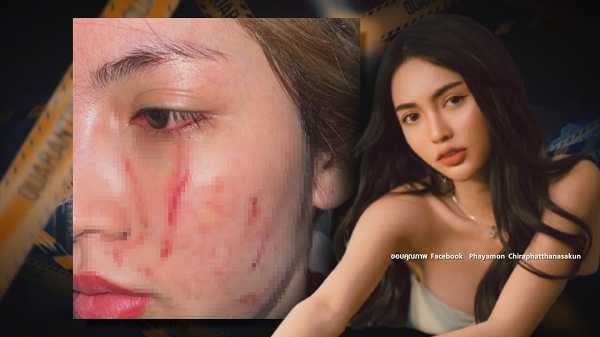 “โนอา” มอบหลักฐานเพิ่มเติมให้ตำรวจ  (มีคลิป)