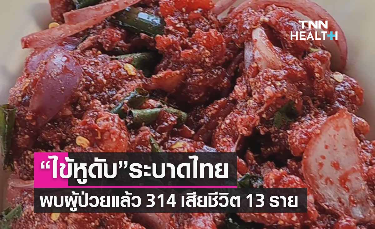 “ไข้หูดับ” ระบาด! พบผู้ป่วยแล้ว 314 เสียชีวิต 13 ราย ย้ำอย่าบริโภคเนื้อหมูดิบ