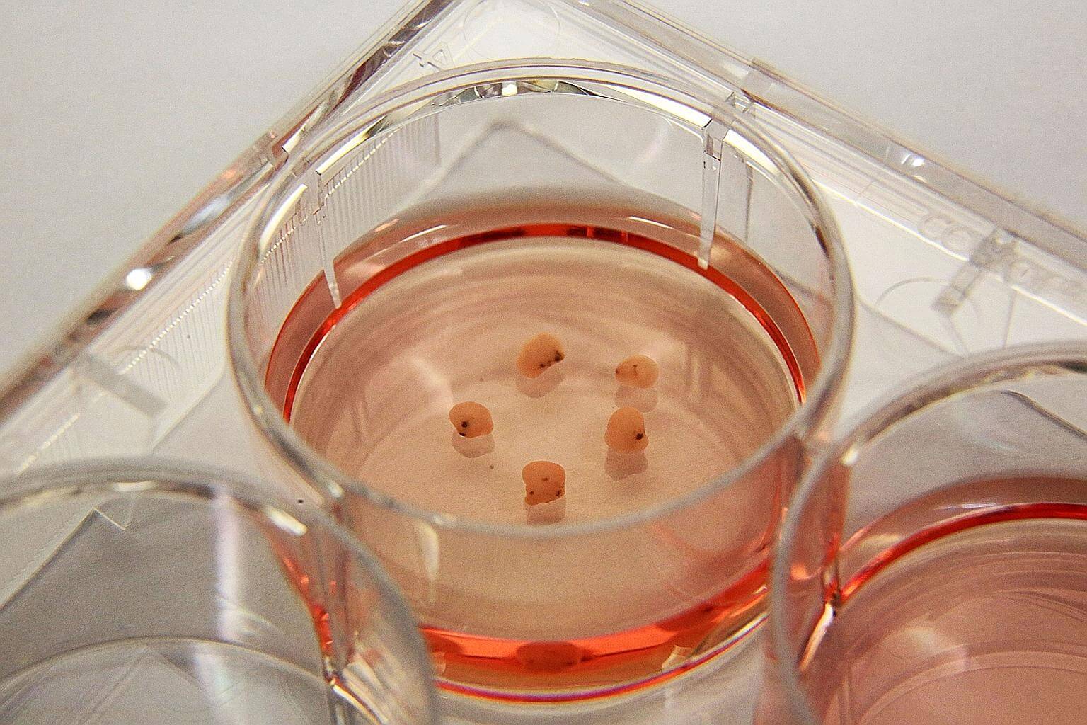 สมองจิ๋ว (Mini brain) จากห้องวิจัยเยอรมนี สามารถงอก ดวงตา ออกมาได้แล้ว !! สมองจิ๋ว (Mini brain) จากห้องวิจัยเยอรมนี สามารถงอก ดวงตา ออกมาได้แล้ว !!