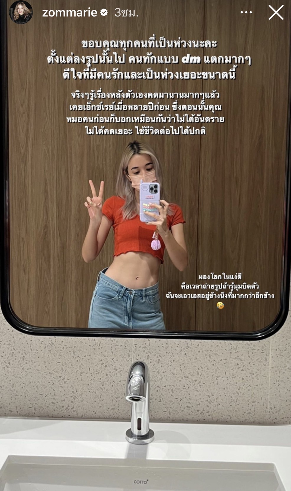ส้ม มารี เผยสาเหตุเป็นวัยรุ่นกระดูกคด ขอบคุณทุกคนที่เป็นห่วง...