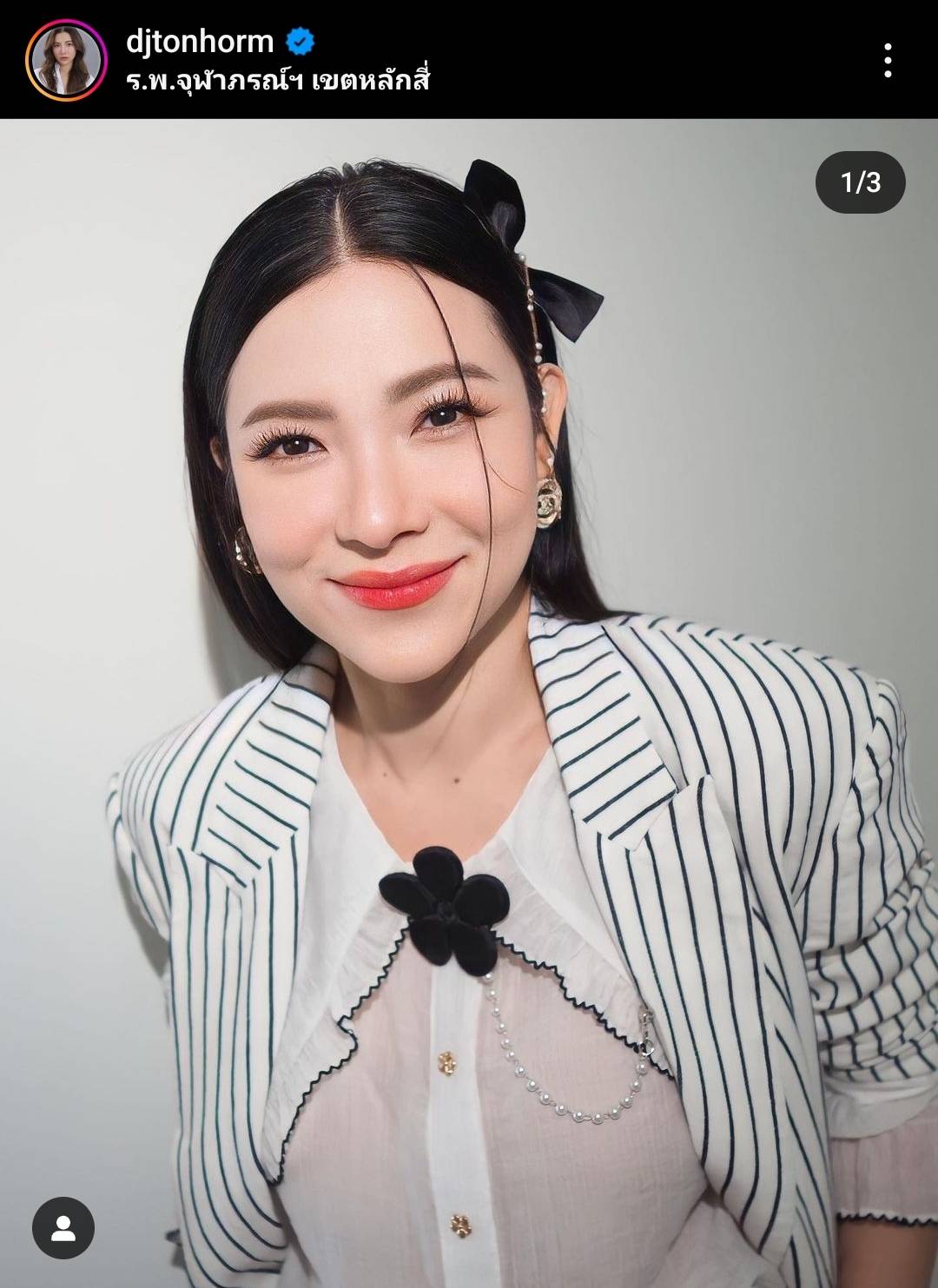 “ต้นหอม” ใจจะขาด “น้องปกป้อง” โดนไวรัส RSVเล่นงาน “ต้นหอม” ใจจะขาด “น้องปกป้อง” โดนไวรัส RSVเล่นงาน