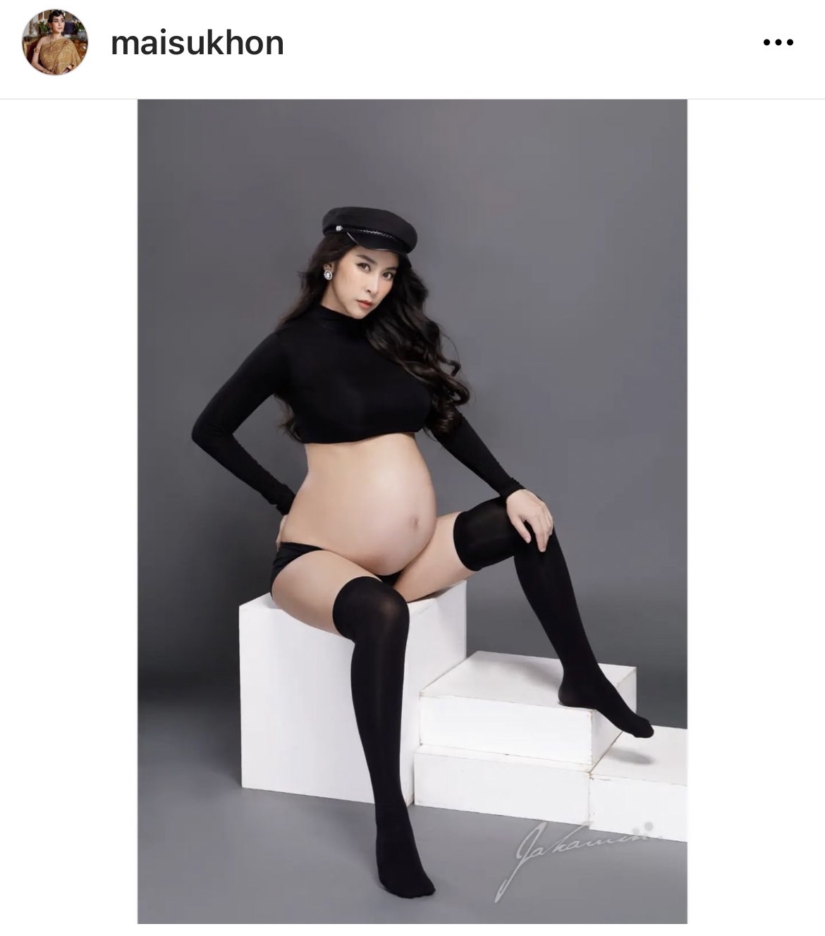 ดีเจต้น เผยลูกสาว น้องชีต้าร์ มีภาวะหัวใจเต้นผิดจังหวะ