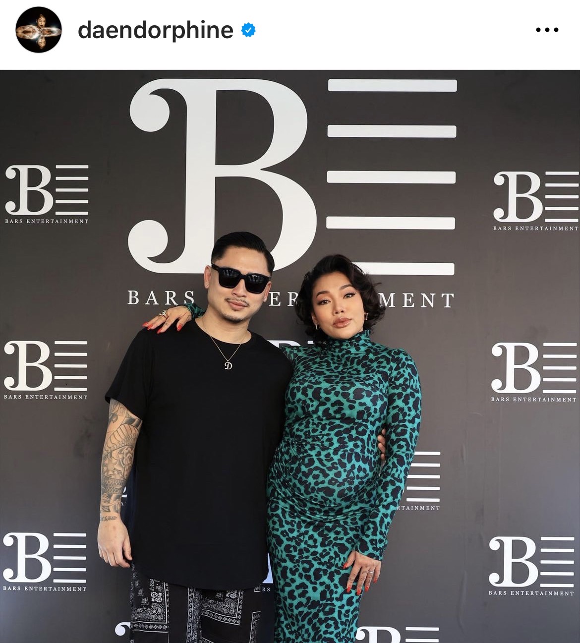 ดา - เดนนิส เฉลยเพศเบบี๋คนแรก ได้ลูกชาย