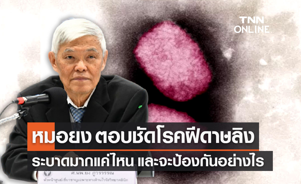 หมอยง ตอบชัด "โรคฝีดาษลิง" ระบาดมากแค่ไหน และจะป้องกันอย่างไร