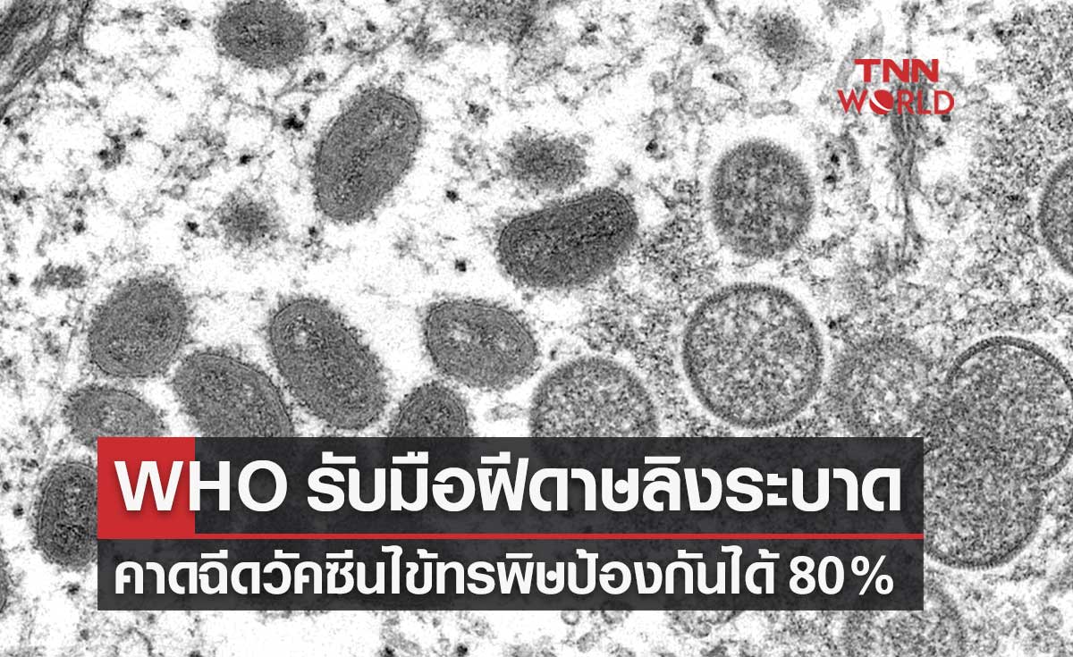 WHO ประชุมฉุกเฉินรับมือโรคฝีดาษลิง คาดฉีดวัคซีนไข้ทรพิษป้องกันได้ 80%