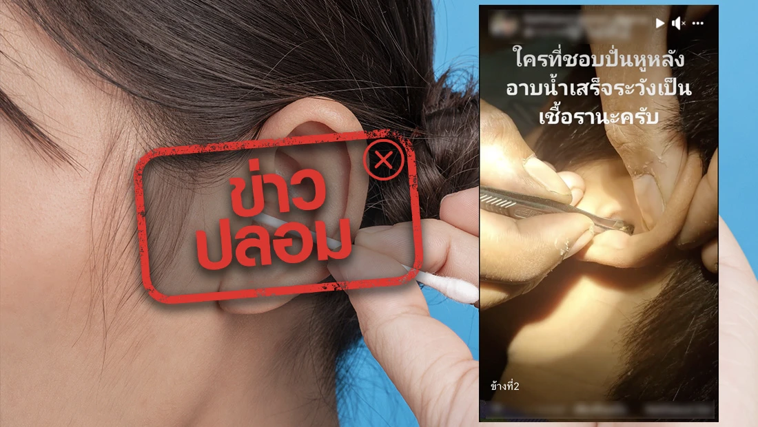 ปั่นหูหลังอาบน้ำระวัง!เป็นเชื้อรา หมอตอบชัดจริงหรือ? ปั่นหูหลังอาบน้ำระวัง!เป็นเชื้อรา หมอตอบชัดจริงหรือ?