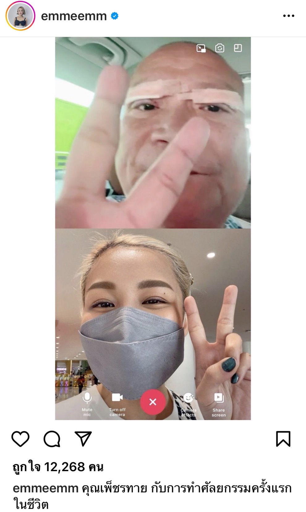 โหน่ง แซว หม่ำ จ๊กมก หล่อจนพระเอกต้องหลบ หลังทำศัลยกรรมครั้งแรก โหน่ง แซว หม่ำ จ๊กมก หล่อจนพระเอกต้องหลบ หลังทำศัลยกรรมครั้งแรก