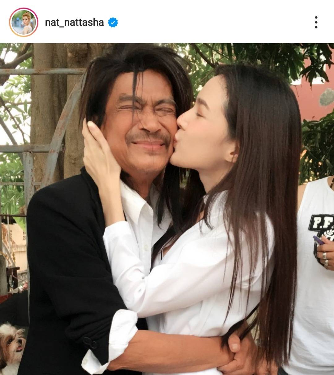 แนท อัปเดตอาการคุณพ่อ แหลม มอริสัน ดีขึ้นเรื่อยๆ ห่วงเรื่องการเดินต้องระวัง แนท อัปเดตอาการคุณพ่อ แหลม มอริสัน ดีขึ้นเรื่อยๆ ห่วงเรื่องการเดินต้องระวัง