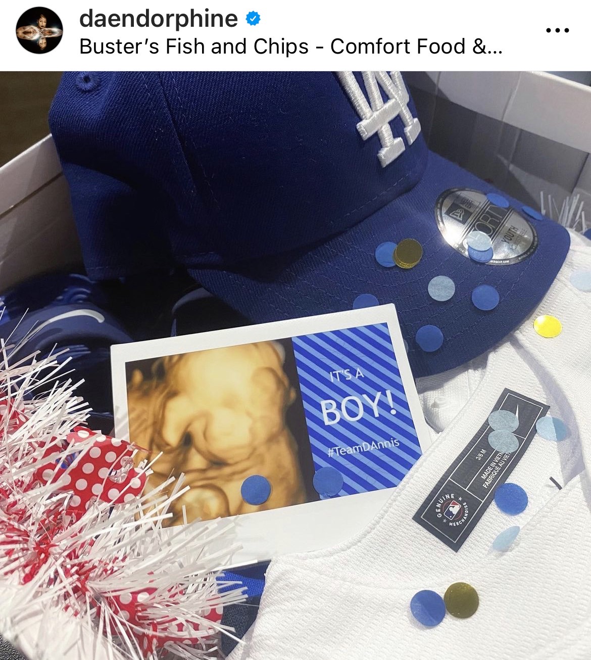 ดา - เดนนิส เฉลยเพศเบบี๋คนแรก ได้ลูกชาย ดา - เดนนิส เฉลยเพศเบบี๋คนแรก ได้ลูกชาย