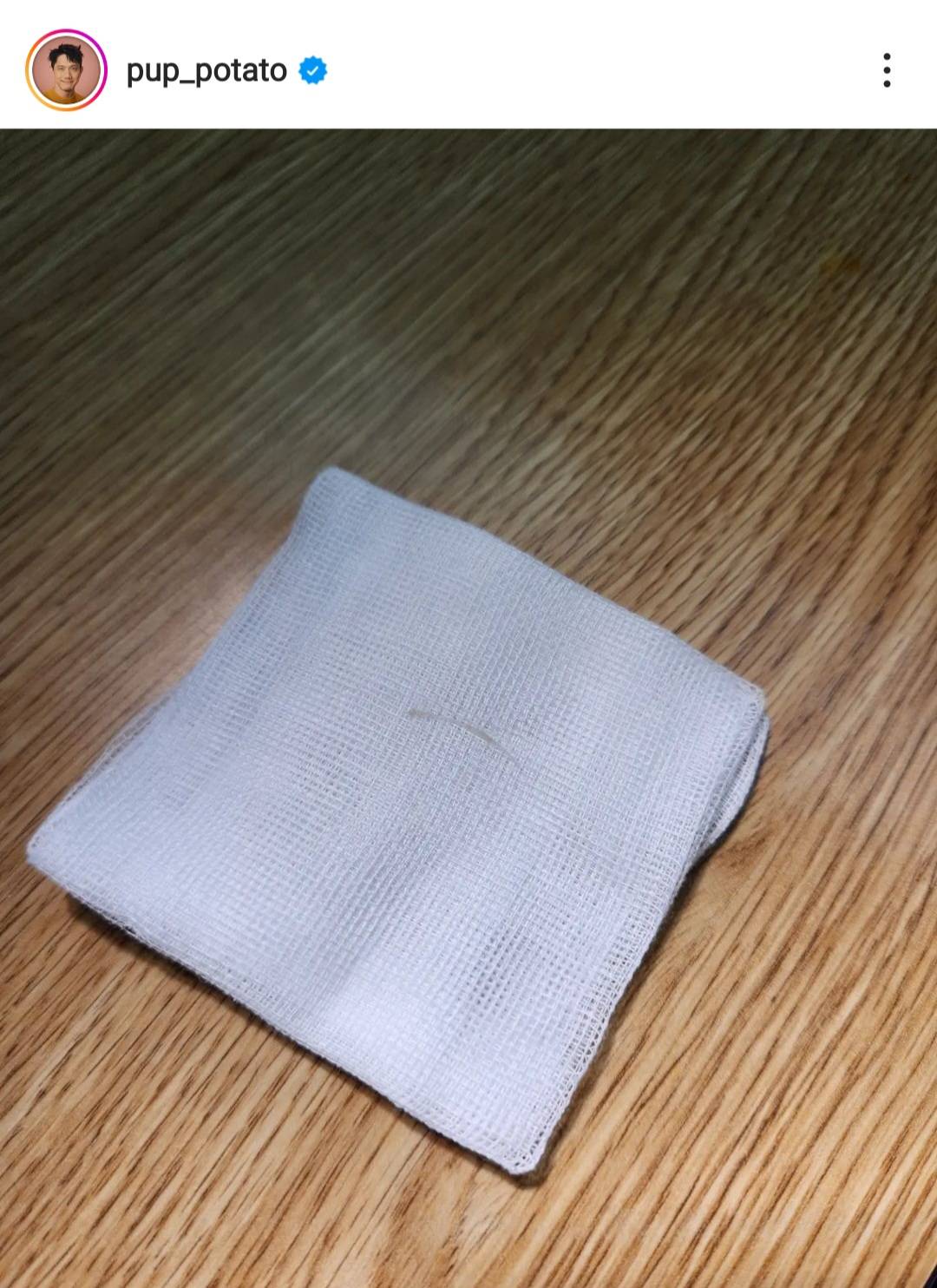 ปั๊บ โปเตโต้ แชร์ประสบการณ์ ก้างติดคอ ต้องล้วงคอลึกมาก ปั๊บ โปเตโต้ แชร์ประสบการณ์ ก้างติดคอ ต้องล้วงคอลึกมาก