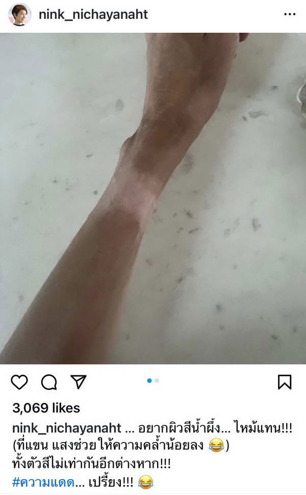 ส่งกำลังใจ นิ้ง กุลสตรี ทำเคมีบำบัด ทานยาตลอดชีวิต น้ำหนักลดเกือบ4กก. ส่งกำลังใจ นิ้ง กุลสตรี ทำเคมีบำบัด ทานยาตลอดชีวิต น้ำหนักลดเกือบ4กก.